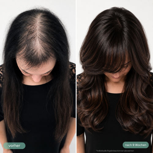 Intense Hair Growth Serum™